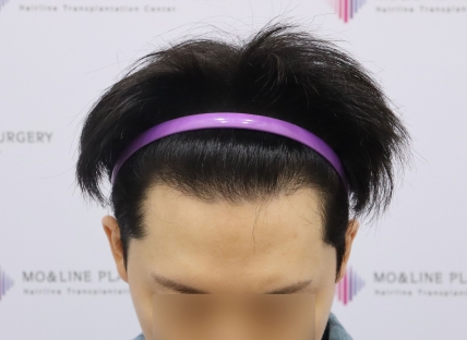 치료후기 이미지